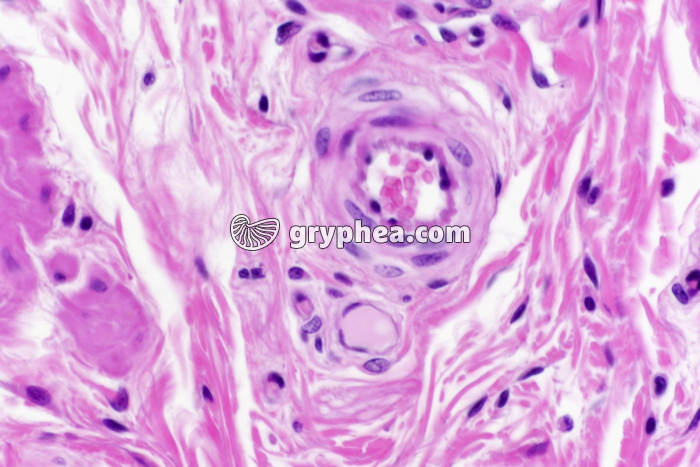 Vaisseau lymphatique et capillaire sanguin x200 - gryphea.org